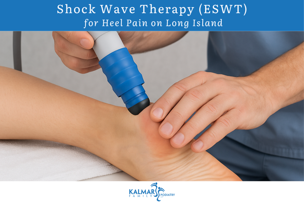 Shock Wave Therapy (ESWT) for Heel Pain on Long Island