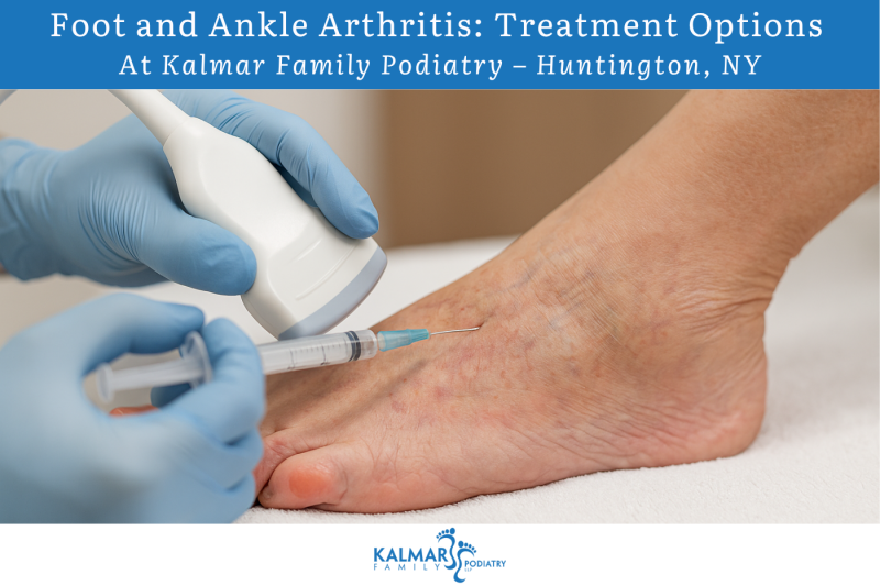 Foot and Ankle Arthritis Treatment Options at Kalmar Family Podiatry