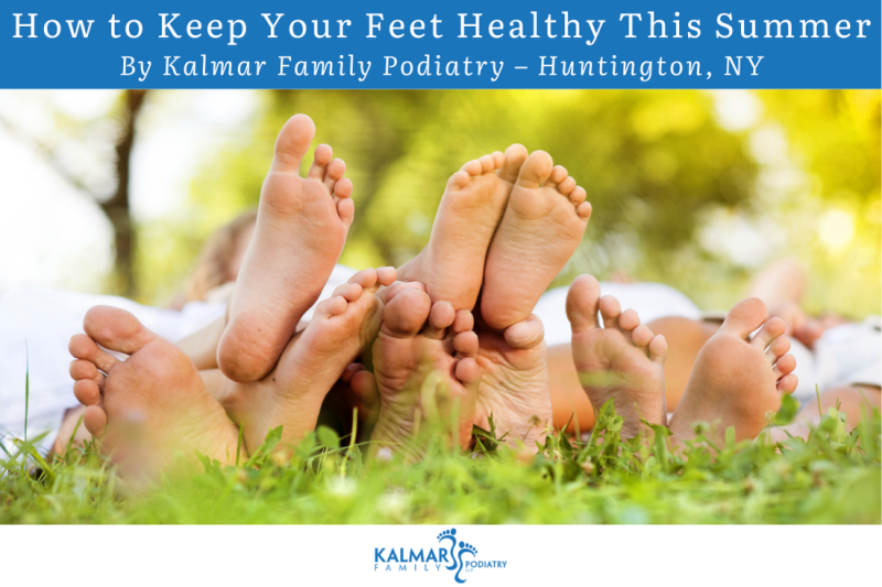 How to Keep Your Feet Healthy This Summer